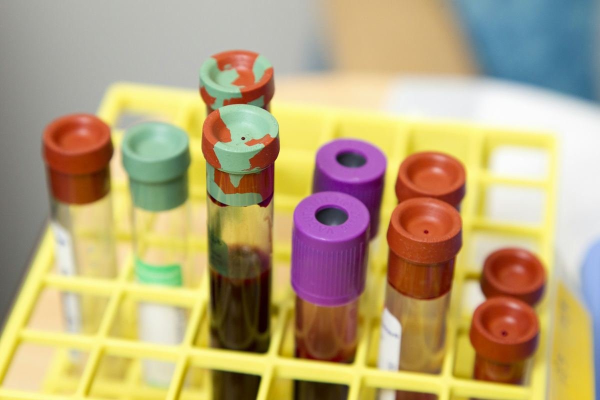 Blood sample tubes with coloured caps in a laboratory rack.