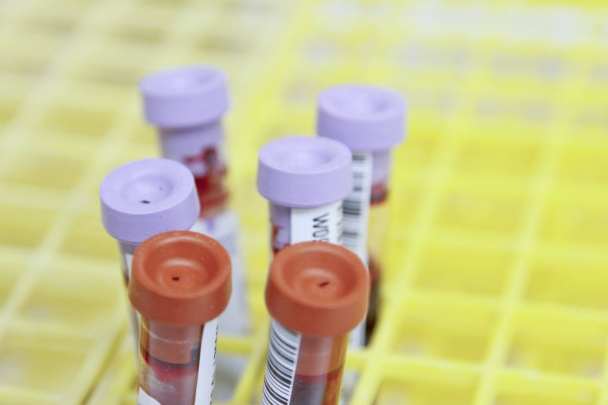 Blood samples in test tubes in a laboratory rack.