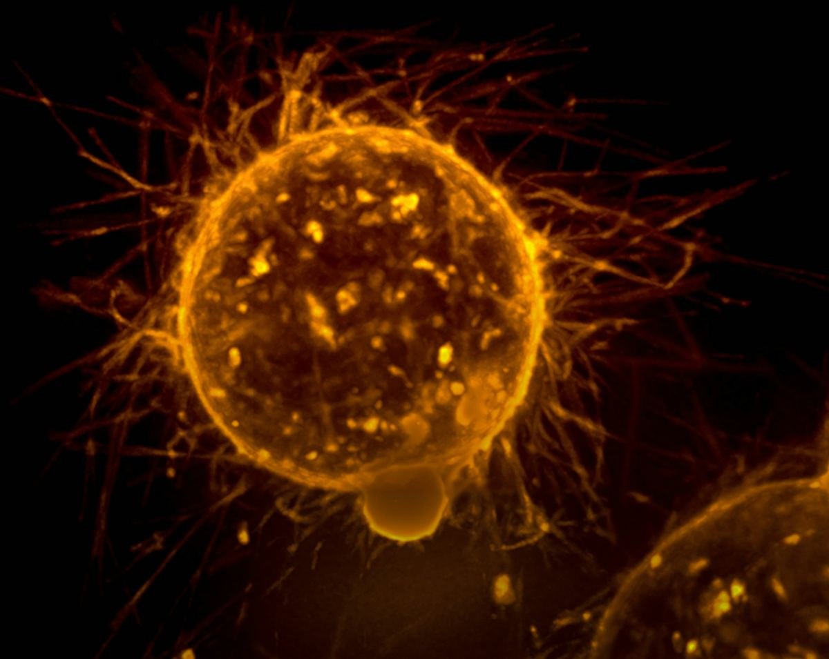Microscope image of a single cell glowing amber against a dark background.