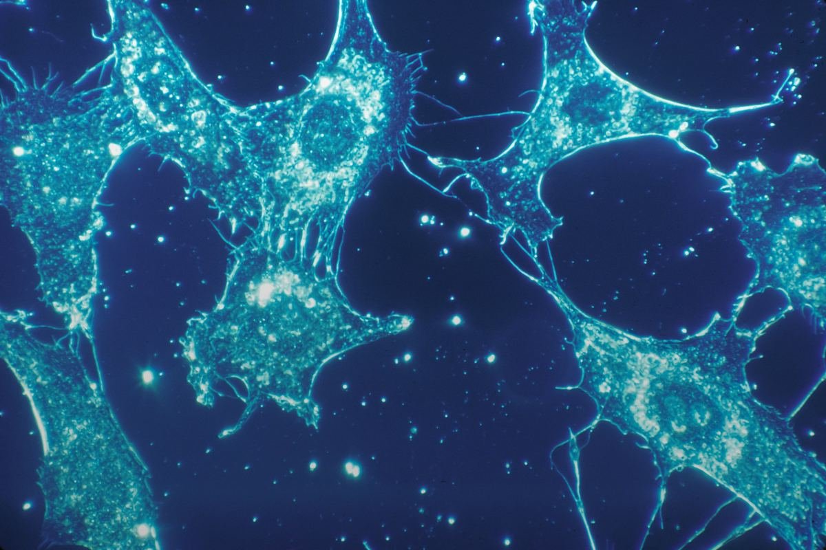 Fluorescent microscope image of cells with irregular shapes on a dark background.