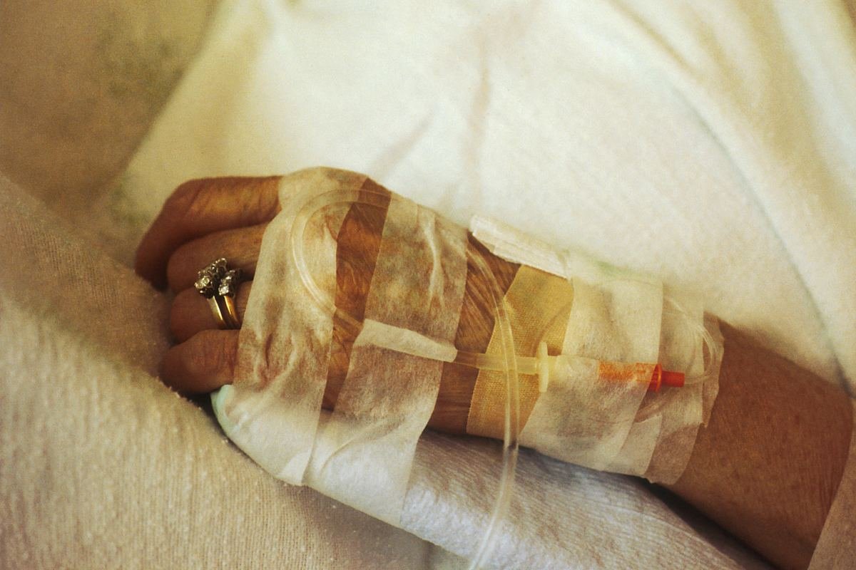 An intravenous line on a patient’s hand during treatment.