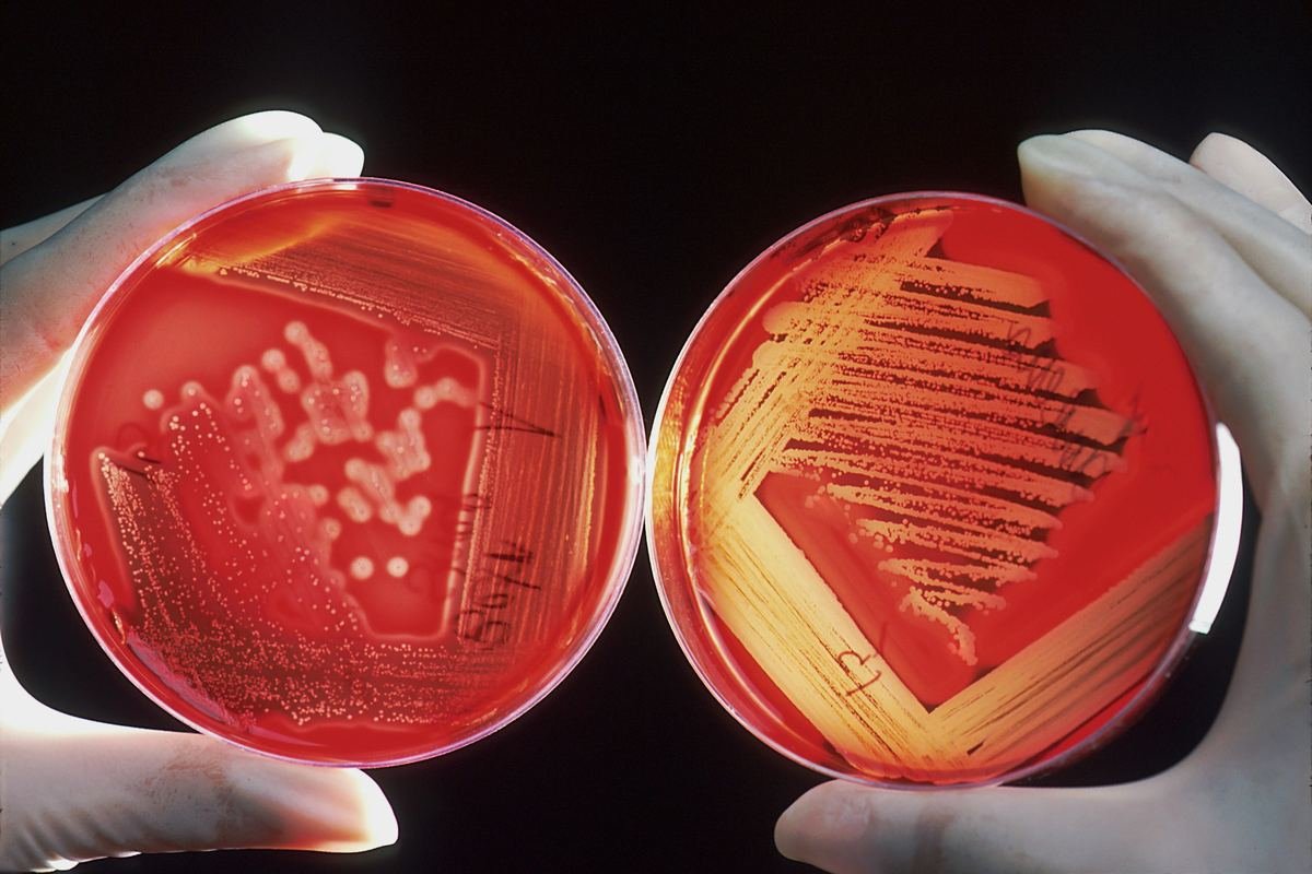 Gloved hands holding a red blood agar plate in a laboratory.