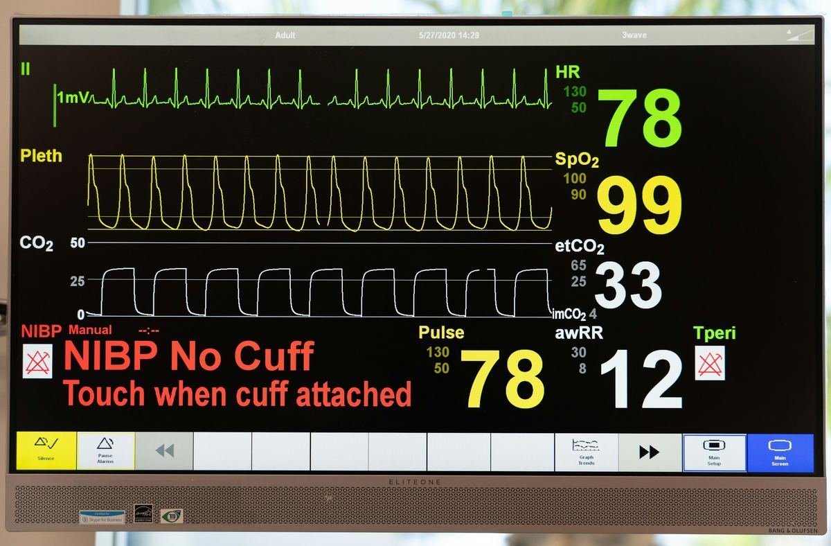 A hospital vital-signs monitor.